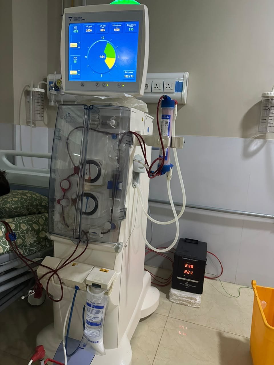 Al Rasheed Hospital HDF Dialysis Machine